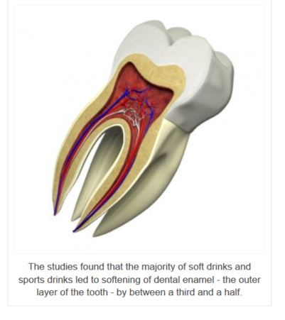 Experts Warn that Sugar Free Drinks Can Harm Teeth